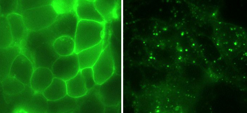 FERROPORTIN green